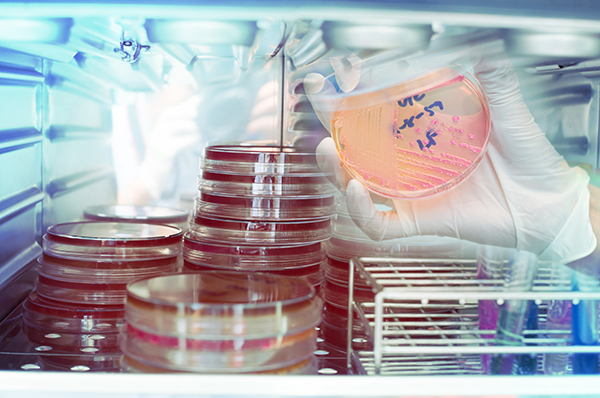 incubating settle plates or petri dishes incubating settle plates or petri dishes